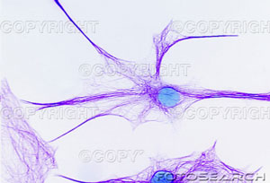 brain-cell.jpg